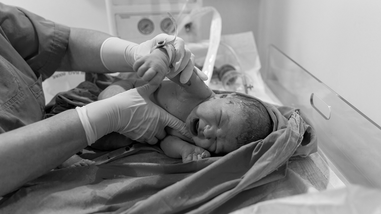 A baby cries after being delivered. 