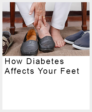How diabetes affects your feet